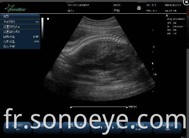 C10 Color Doppler Ultrasound System For Hostipal